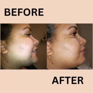 5 Minute Hair Remover Cream Kit