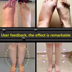 Sugar Control LI4 Acupressure Point Clip