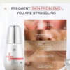 Dark Spot Corrector Face Serum