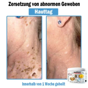 Raindew™ Bee Venom Multi-Symptom Treatment Cream