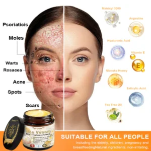Turonu™ Bee VenomTreatment cream