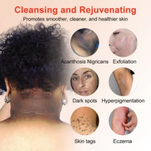 Fivfivgo™ Purifying Exfoliating Gel for Acanthosis Nigricans, Exfoliation