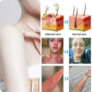 Fivfivgo™ Purifying Exfoliating Gel for Acanthosis Nigricans, Exfoliation