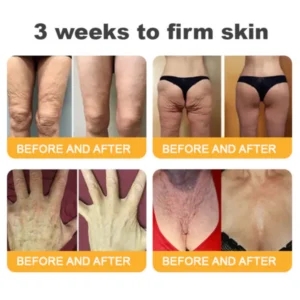Furzero™ Advanced Collagen Peptide Firming Cream