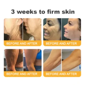 Furzero™ Advanced Collagen Peptide Firming Cream