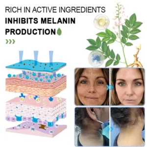 Fivfivgo™ Purifying Exfoliating Gel for Acanthosis Nigricans, Exfoliation