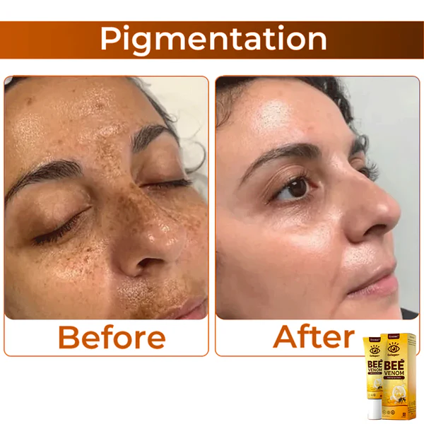 flysmus™ Bee Venom Anti-Sagging Lifting Eye Cream