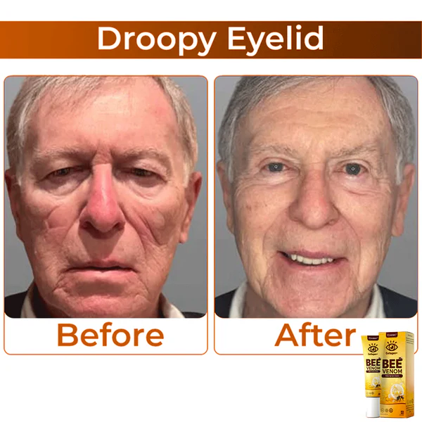 flysmus™ Bee Venom Anti-Sagging Lifting Eye Cream
