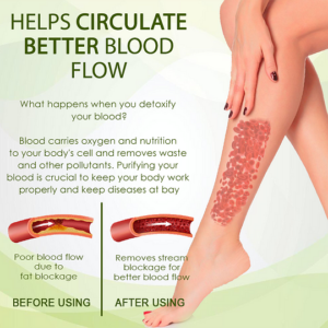 Outeny™ SwellFree Lymphatic Herbal Cream