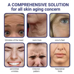 Facelift & Under Eye Tuck