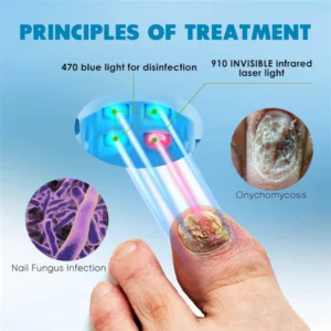 QIAWI™ Revolutionary High-Efficiency Light Therapy Device For Toenail Diseases