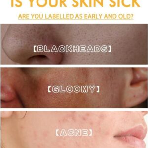 Whitening and Spot Reducing Rejuvenating Honey Tear-Off Mask