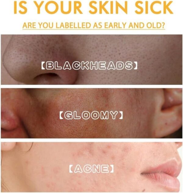 Whitening and Spot Reducing Rejuvenating Honey Tear-Off Mask