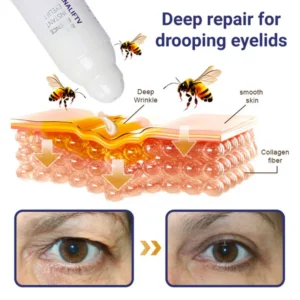 Facelift & Under Eye Tuck
