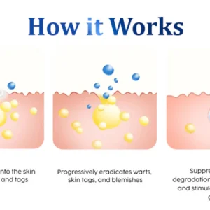 Fivfivgo™ WartsOff Instant Blemish Removal Cream – PREMIUM