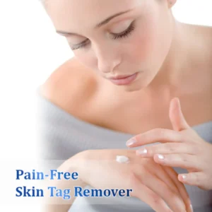 Fivfivgo™ WartsOff Instant Blemish Removal Cream – PREMIUM