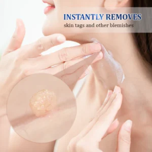 Fivfivgo™ WartsOff Instant Blemish Removal Cream – PREMIUM