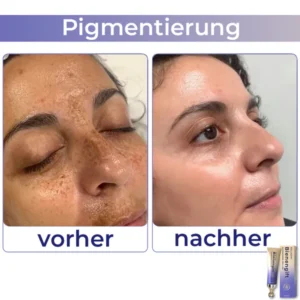 flysmus™ Collagen+ Bee Venom Eye Cream Roll