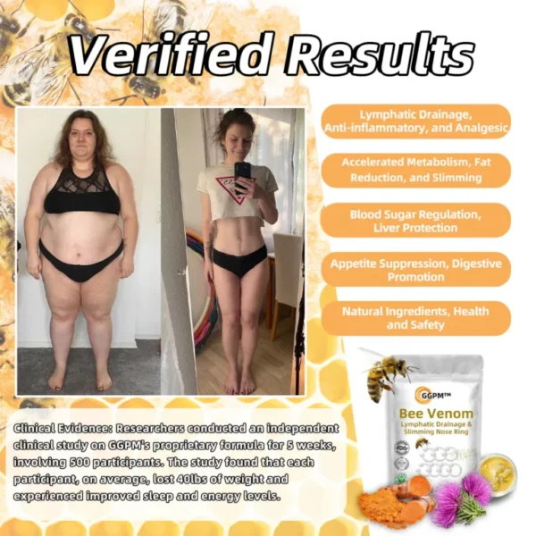 Cvreoz slimming patch with bee venom (for all lymphatic problems and obesity)