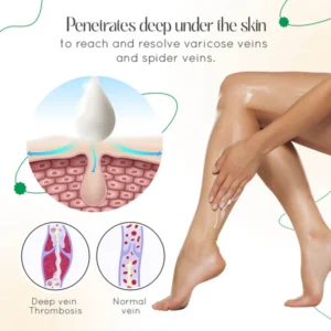 LOVILDS™ Vein Therapy Cream