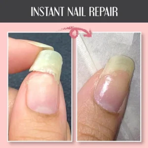 BQYOOM™Nail Repair Protection Gel