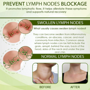 Outeny™ SwellFree Lymphatic Herbal Cream