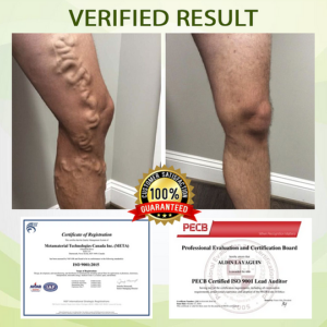 Outeny™ SwellFree Lymphatic Herbal Cream