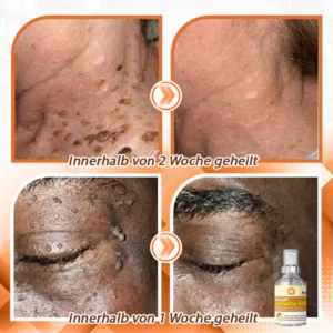flysmus™ Bee Venom Quick Relief Versatile Skin Spray