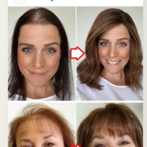 Anti-hair loss serum Buy 1 Get 1 Free