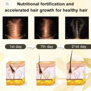 Anti-hair loss serum Buy 1 Get 1 Free