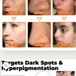 Herbal Spots Peel-Off Facial Mask