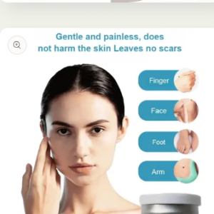Mole removal and wart removal cream Buy 1 Get 1 Free