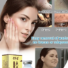 Mole removal and wart removal cream Buy 1 Get 1 Free