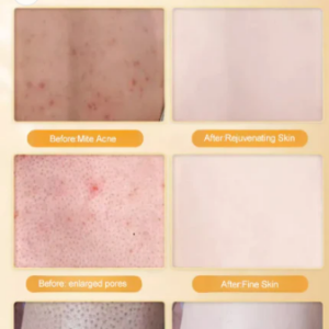 Sulfur Mite Removing Shower Gel