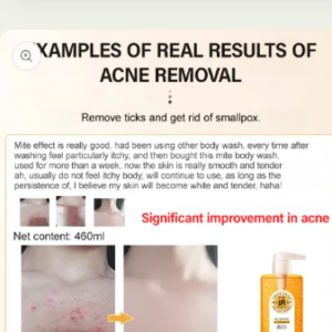 Sulfur Mite Removing Shower Gel