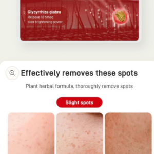 Whitening Spot Lightening Cream
