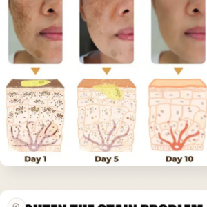Whitening Skin Melanin Correcting Facial Serum