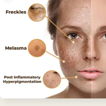 Whitening Skin Melanin Correcting Facial Serum