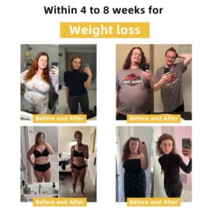 Cvreoz slimming patch with bee venom (for all lymphatic problems and obesity)