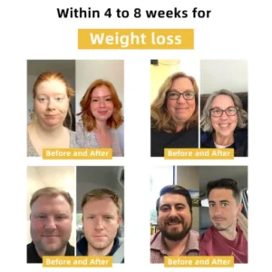 Cvreoz slimming patch with bee venom (for all lymphatic problems and obesity)