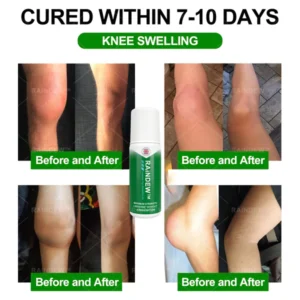 Raindew™ Lidocaine Pain Relief Roll-On