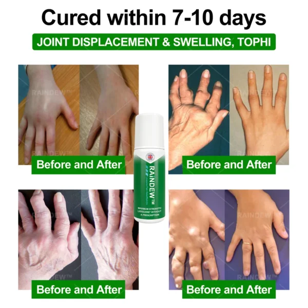 Raindew™ Lidocaine Pain Relief Roll-On
