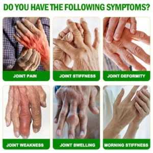 Raindew™ Lidocaine Pain Relief Roll-On