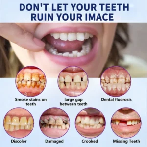 Advanced Customized Full Denture Set