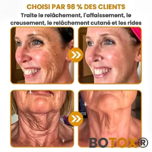 BOTOX® - Reduce Wrinkles in 2 Minutes - Fast and Effective Anti-Aging Serum