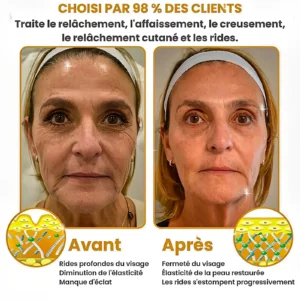 BOTOX® - Reduce Wrinkles in 2 Minutes - Fast and Effective Anti-Aging Serum