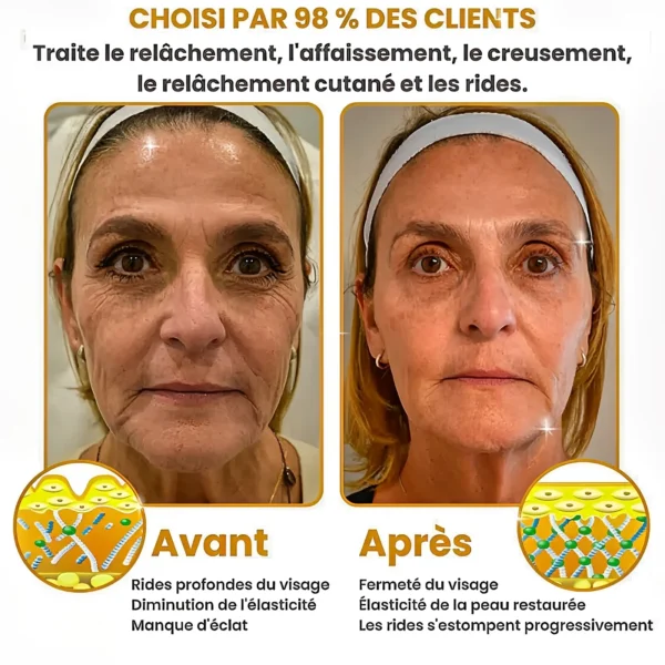 BOTOX® - Reduce Wrinkles in 2 Minutes - Fast and Effective Anti-Aging Serum