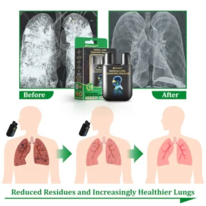 Official Store-Raindew™ Herbal Lung Cleansing Inhaler
