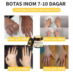HONXI™ Beeswax Joint & Bone Therapy Hug