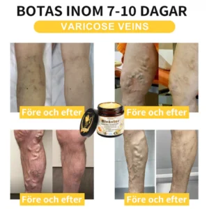 HONXI™ Beeswax Joint & Bone Therapy Hug